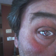 Illustration for article titled Yup, Thats A Kansas City Chiefs Glass Eye